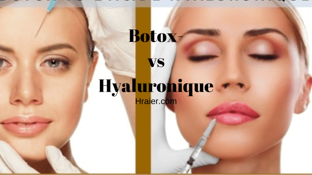 Botox- vs Hyaluronique